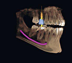 dentiste asnieres 92 radiologie